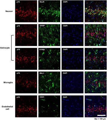 Acute intoxication with diisopropylfluorophosphate promotes cellular senescence in the adult male rat brain